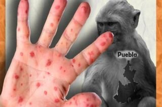 Secretario de Salud de Puebla, asegur&oacute; que homosexuales "tienen mayor riesgo" de contagio de viruela del mono
